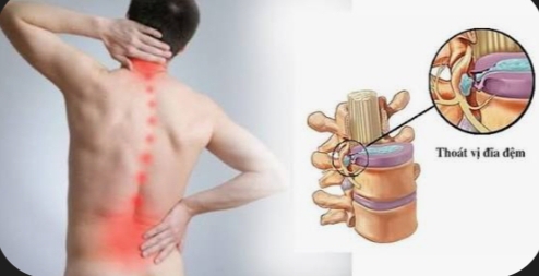 Thấu cốt ôn cân ( trị liệu xương khớp ) - 2