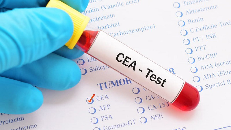 Xét nghiệm Định lượng CEA
