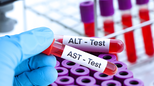 Đo hoạt độ AST, ALT trong máu