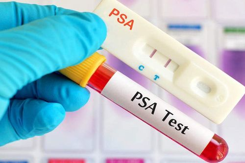 Định lượng PSA toàn phần
